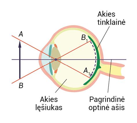 Akies skysčio nutekėjimo ir akispūdžio schema